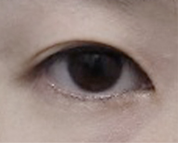 졸린눈