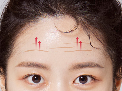 노하우 03