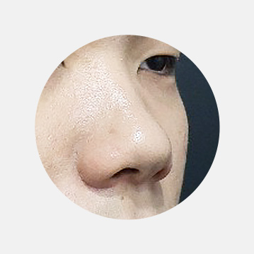 낮은코