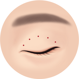 자연유착