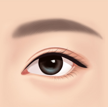 STEP 03