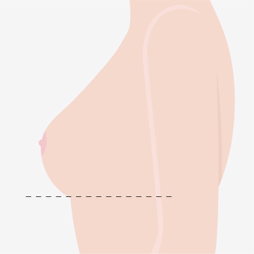 정상